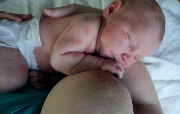 Aktiv amning, bebis sover vid bröstet.